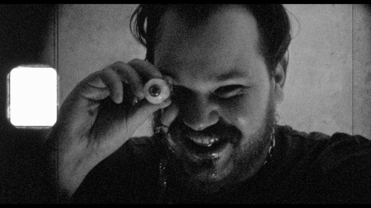 Vinegar Syndrome
