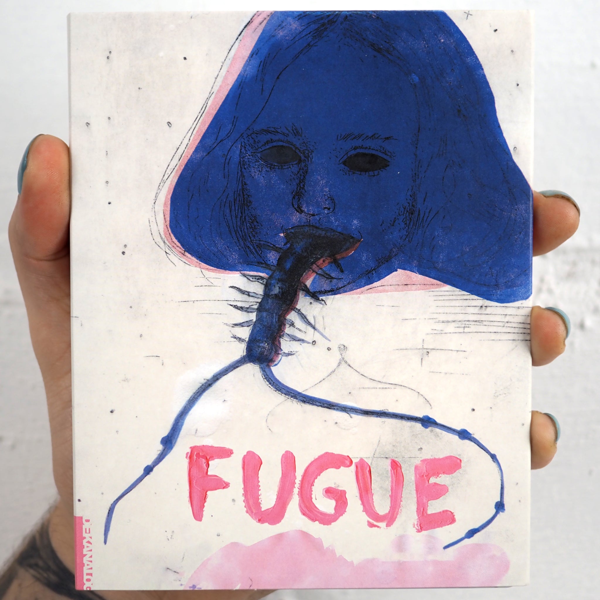 Fugue Vinegar Syndrome