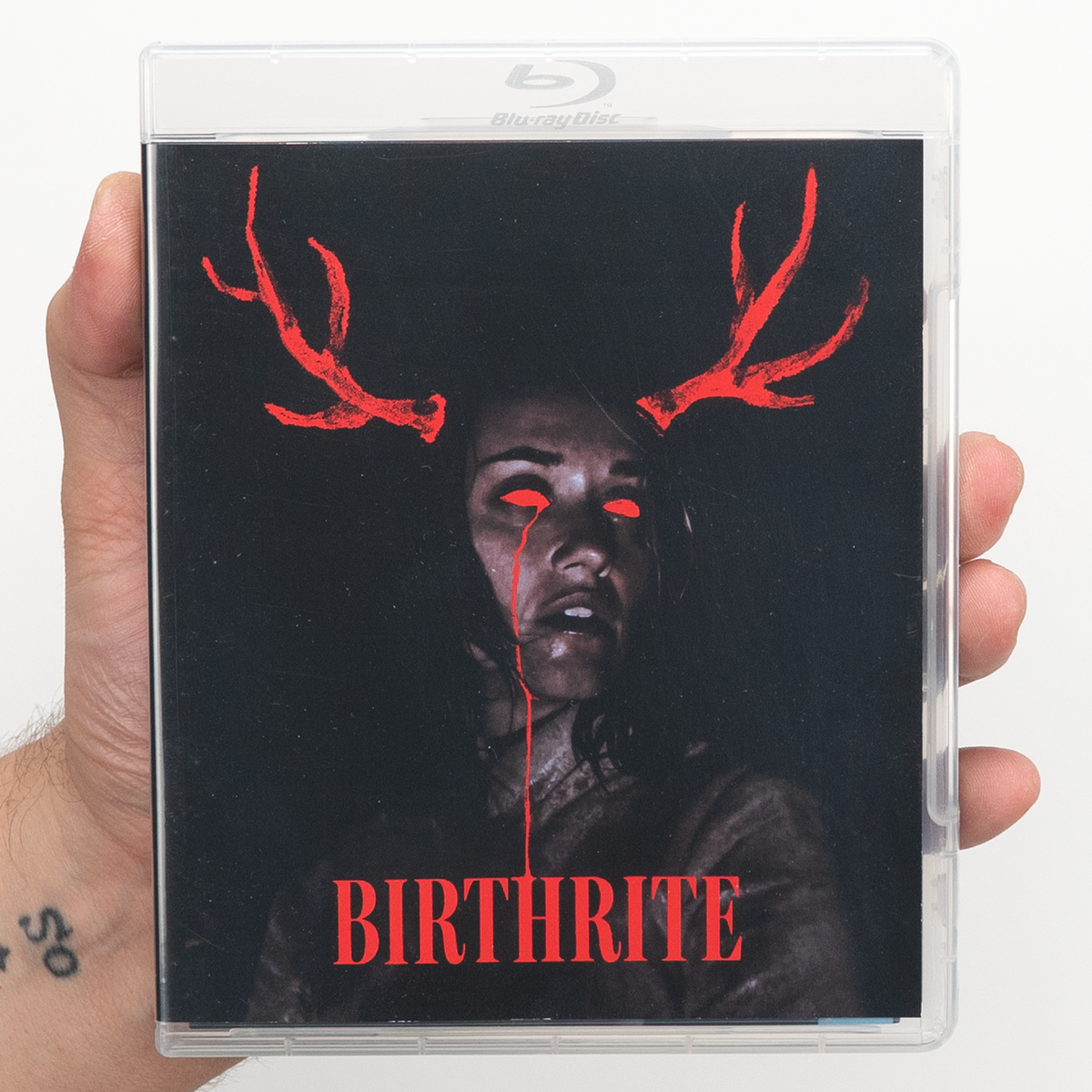 Birthrite