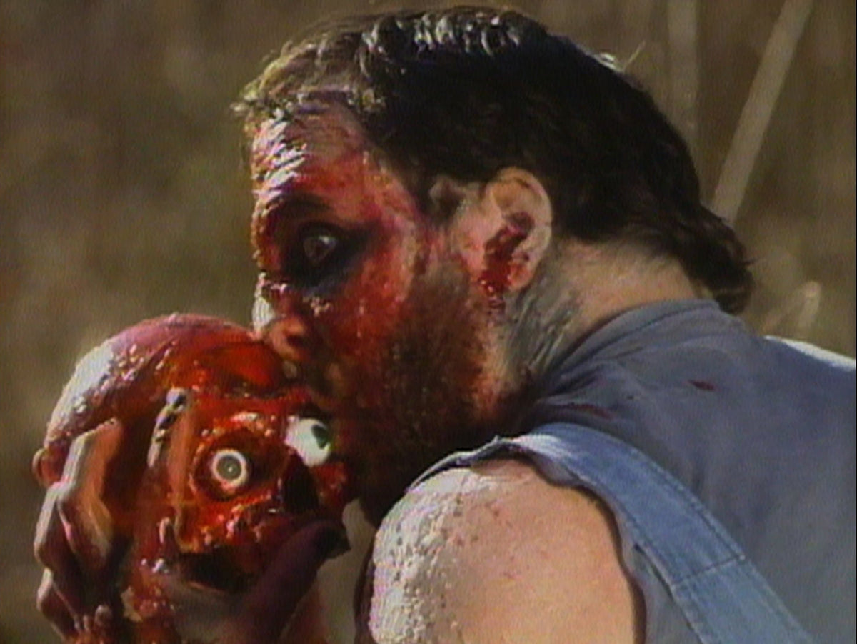 Vinegar Syndrome