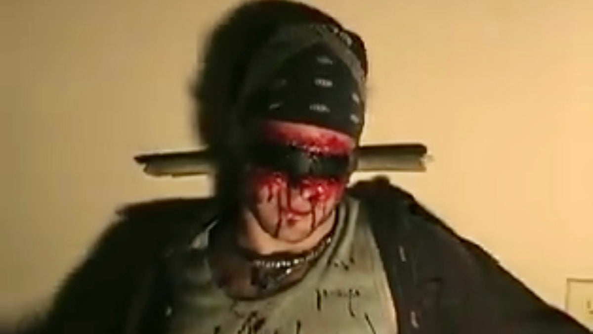 Severe Injuries