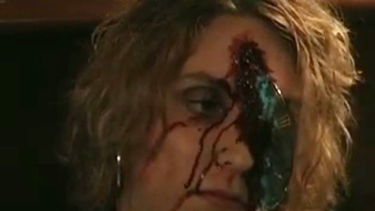 Severe Injuries