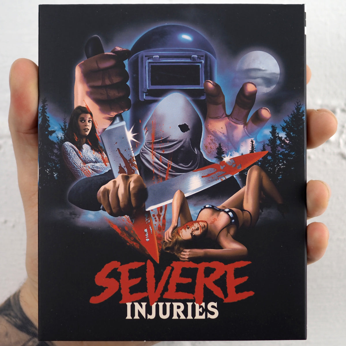 Severe Injuries