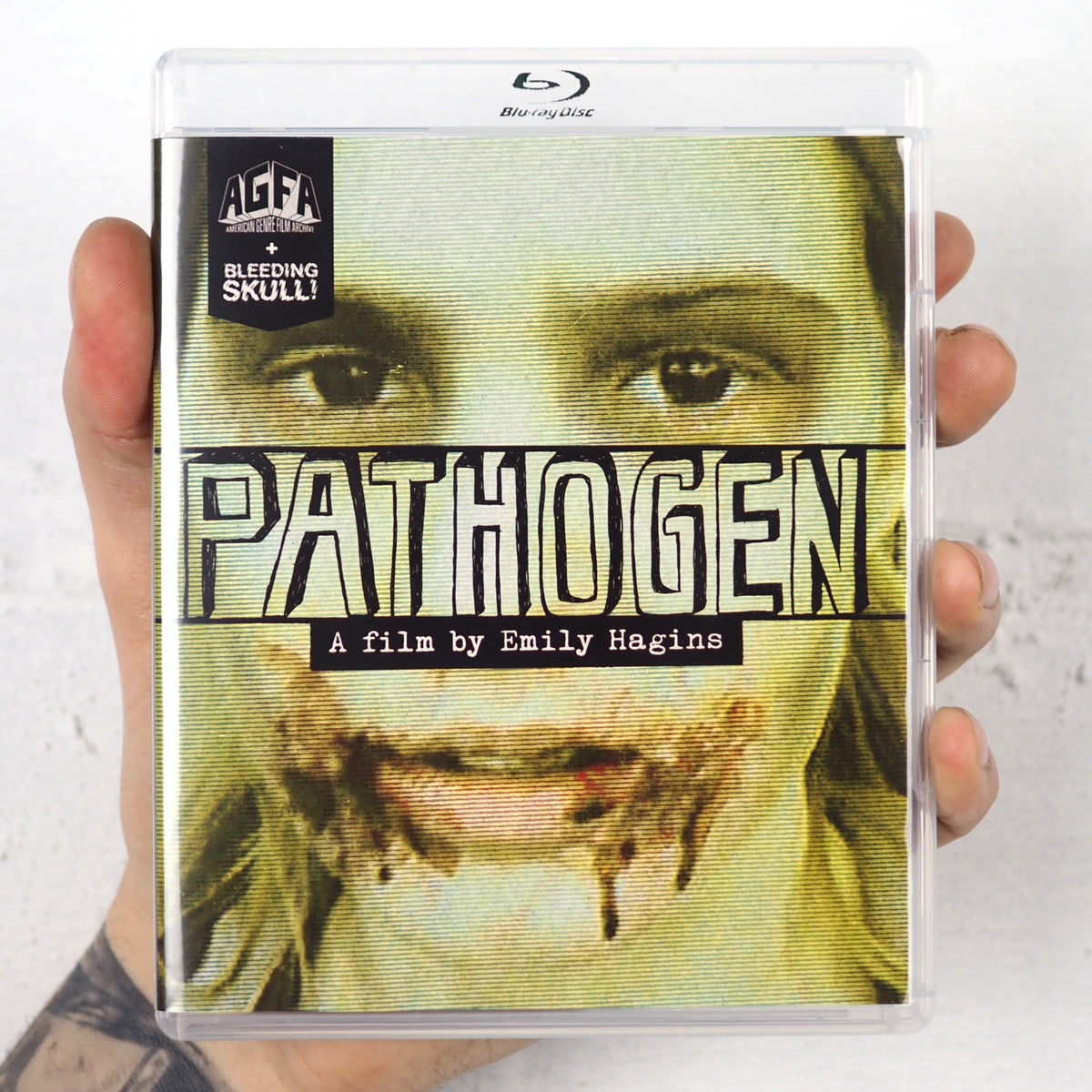 Pathogen