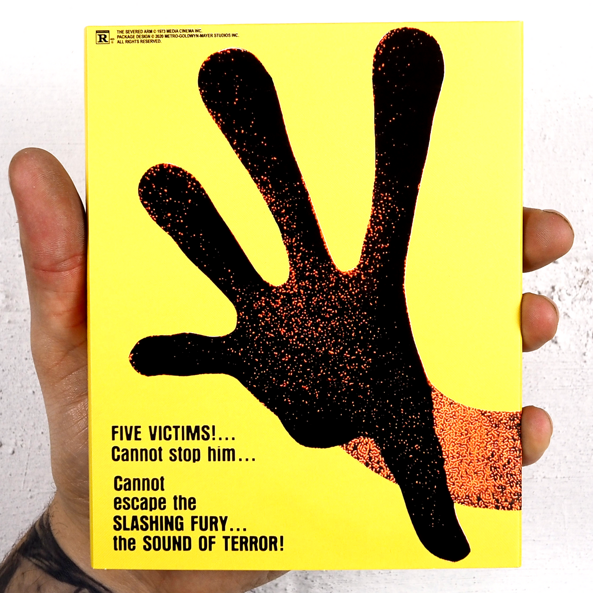 The Severed Arm