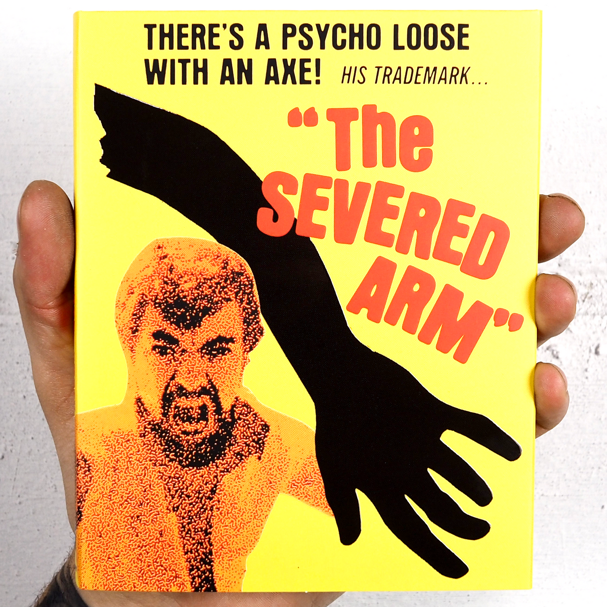 The Severed Arm