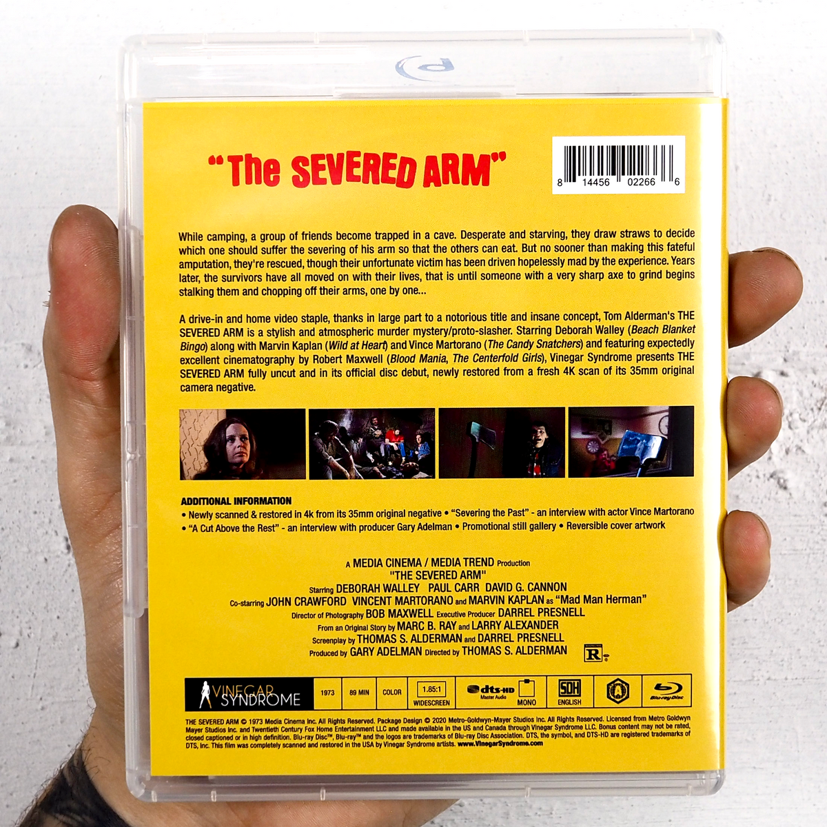 The Severed Arm