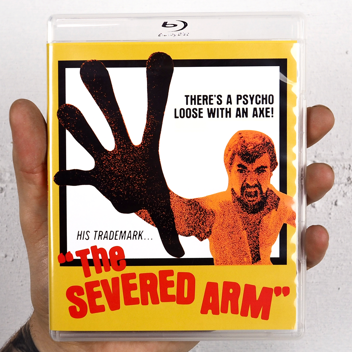 The Severed Arm